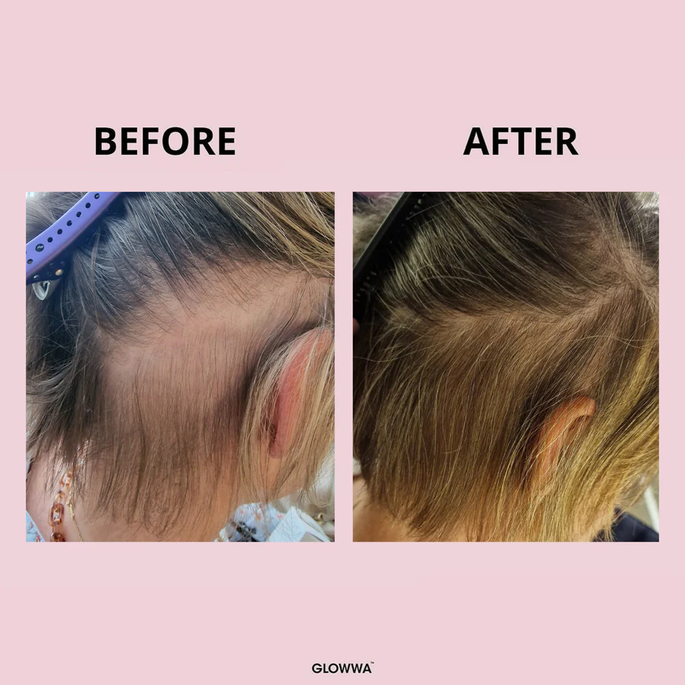 GLOWWA HAIR FOOD™
