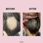 GLOWWA HAIR FOOD™