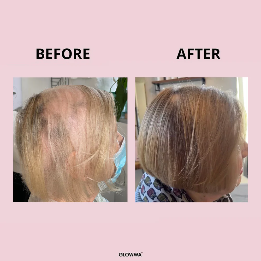 GLOWWA HAIR FOOD™