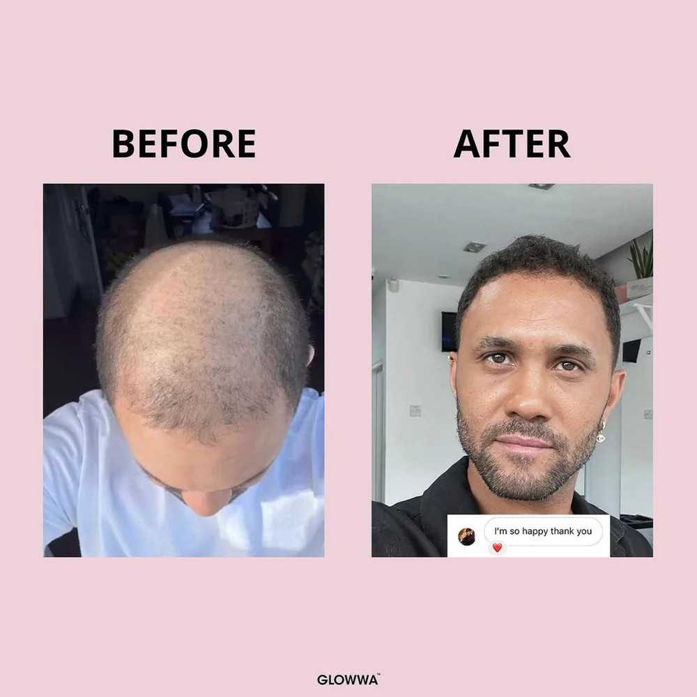 GLOWWA HAIR FOOD™